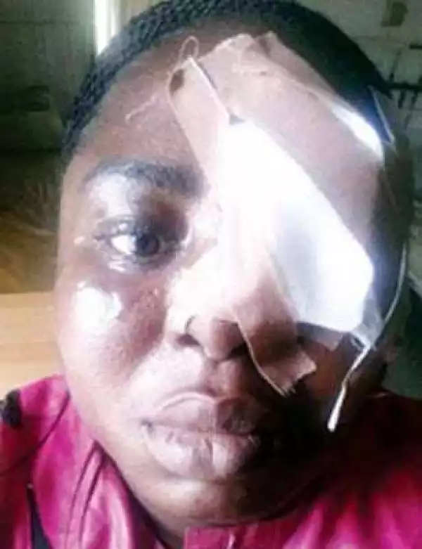 Man who battered wife’s niece declared wanted by police in Lagos